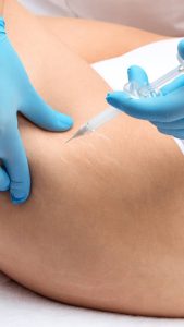 نقاهت بعد از فیلر بادی