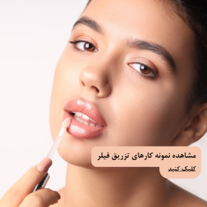 تزریق فیلر لب در چیتگر