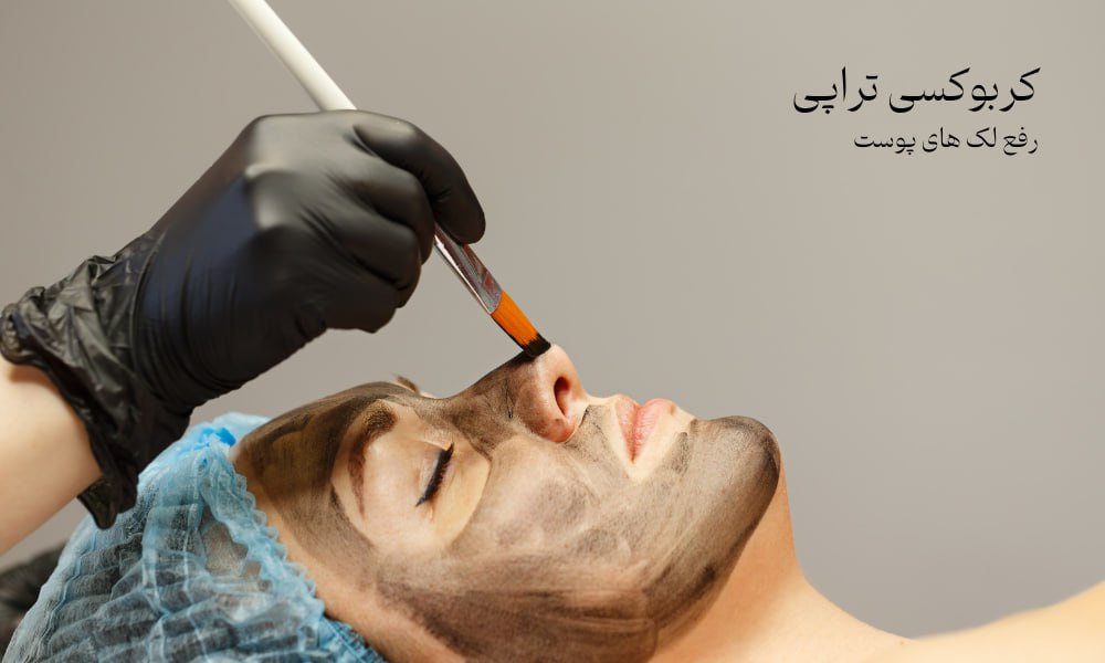 کربوکسی تراپی
