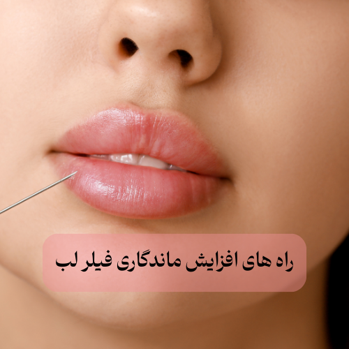 راه های افزایش ماندگاری فیلر لب