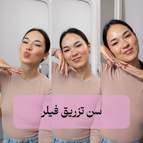 سن تزریق فیلر