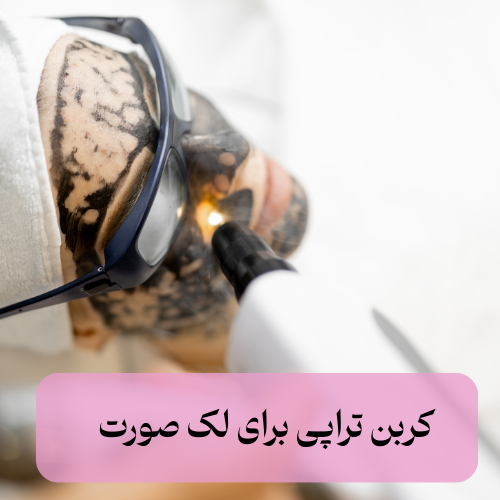 کربن تراپی برای لک صورت