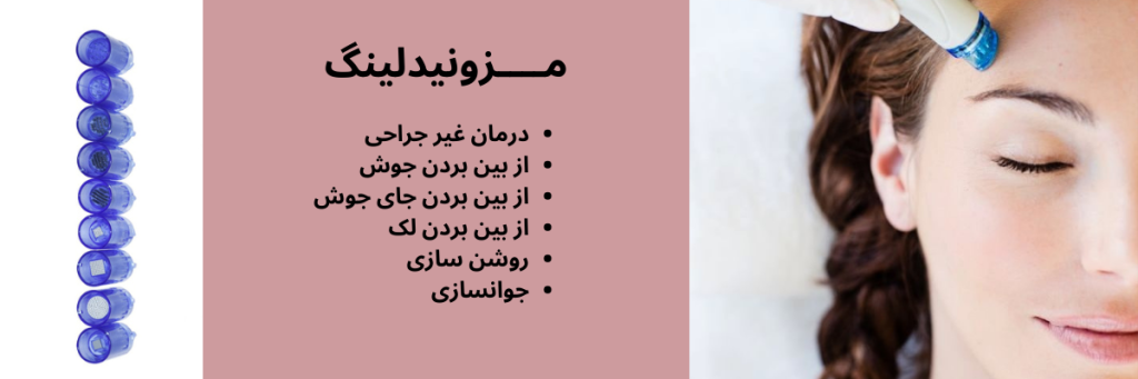 مزونیدلینگ در چیتگر