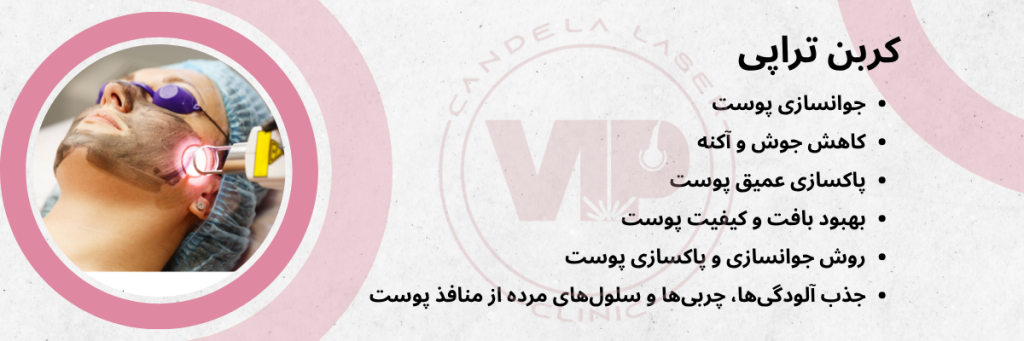 کربن تراپی صورت در چیتگر