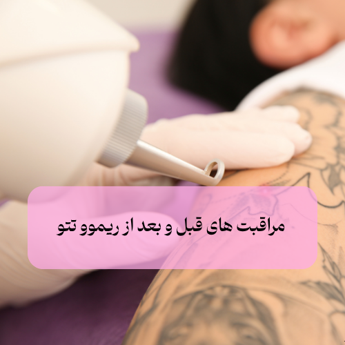 مراقبت های قبل و بعد از ریموو تتو