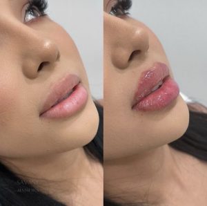 انواع مدل ژل لب با عکس