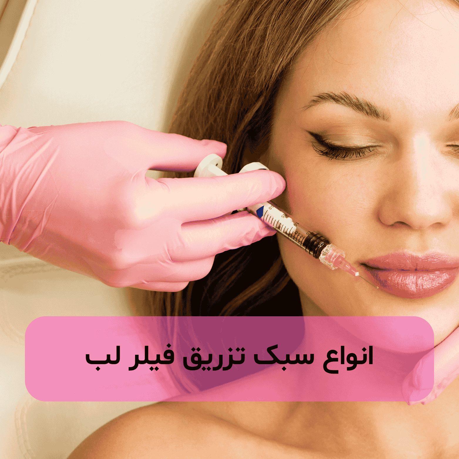 انواع سبک تزریق فیلر لب