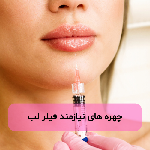 چهره های نیازمند فیلر لب