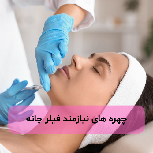 چهره نیازمند فیلر چانه