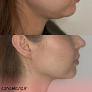 کلینیک لیزر کندلا در شهرک چشمه لیست قیمت
